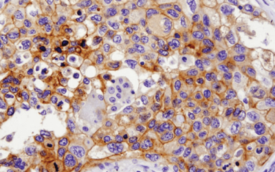 Immunohistochemistry-IHC-13684-PDL1