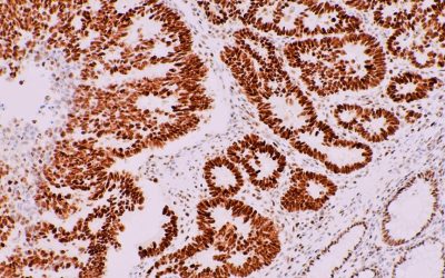 immunohistochemistry-techniques-strengths-limitations-and-applications-363107-960x540